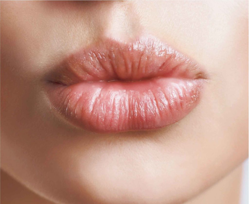 Mc Aesthetics | Face & Skin | lip augmentation